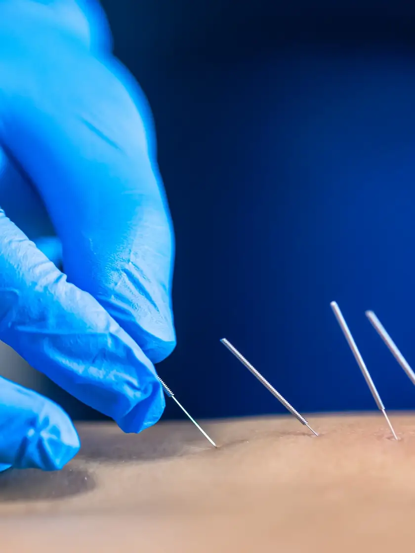 Acupuncture *Coming Soon*